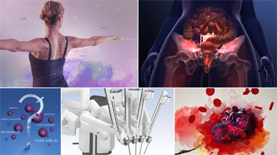 Example of our work at LFC-RX.com